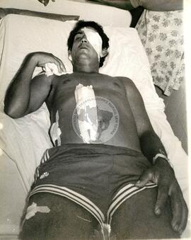 Trabalhador Rural ferido (Goiás, 1987) [fotografia] / Fotógrafo(a) : João Ripper. -- Ref.: BR-SPMST_MST-SN-CIN_AMP_001788-012937-VPP.